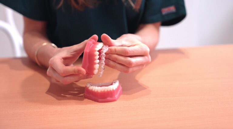 Traitement d'orthodontie par aligneurs invisibles