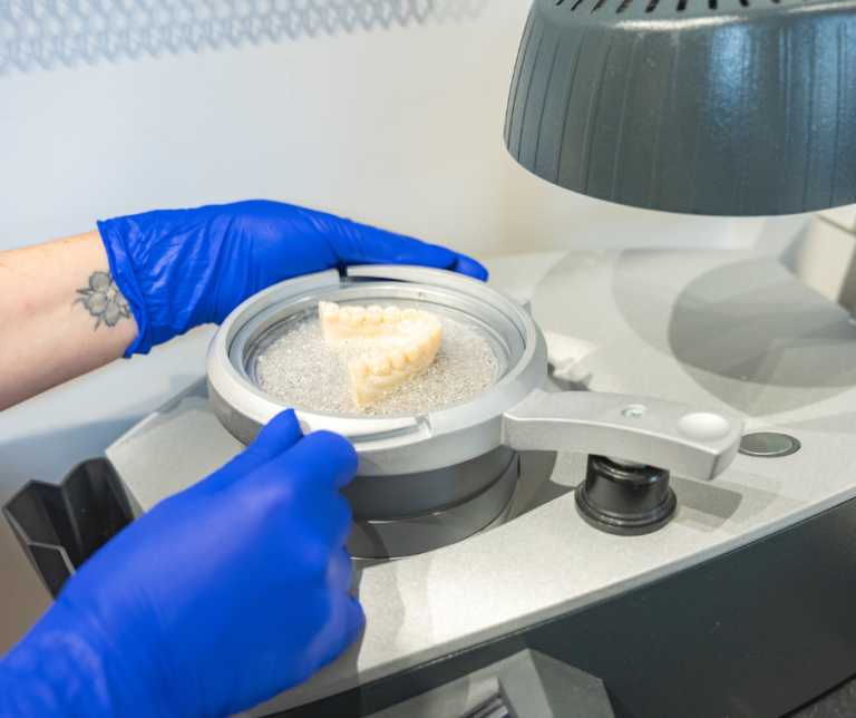 Traitement d'orthodontie par aligneurs invisibles