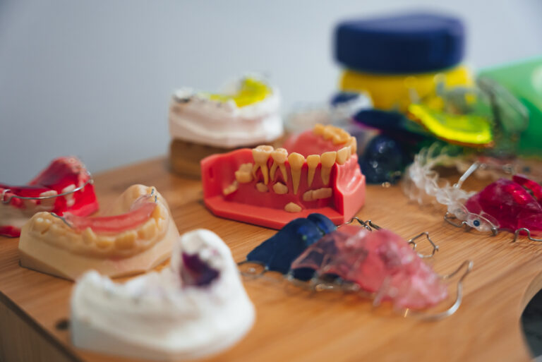 Orthodontie à Marseille : quel est le choix adapté à votre besoin ?