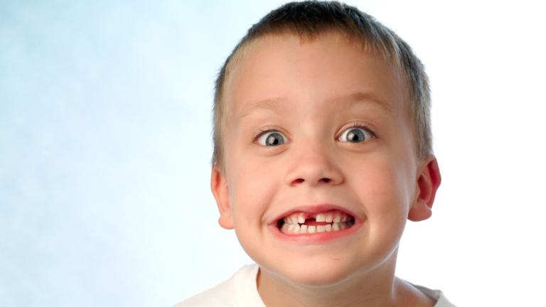 Faut-il remplacer une dent manquante ?