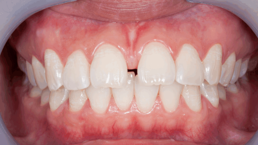 dents du bonheur