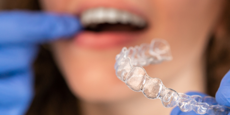 Smile by Les Phocéennes_Orthodontie Adultes_Marseille